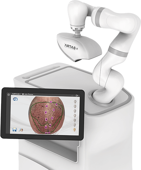 What is ARTAS Robotic Hair Transplant?