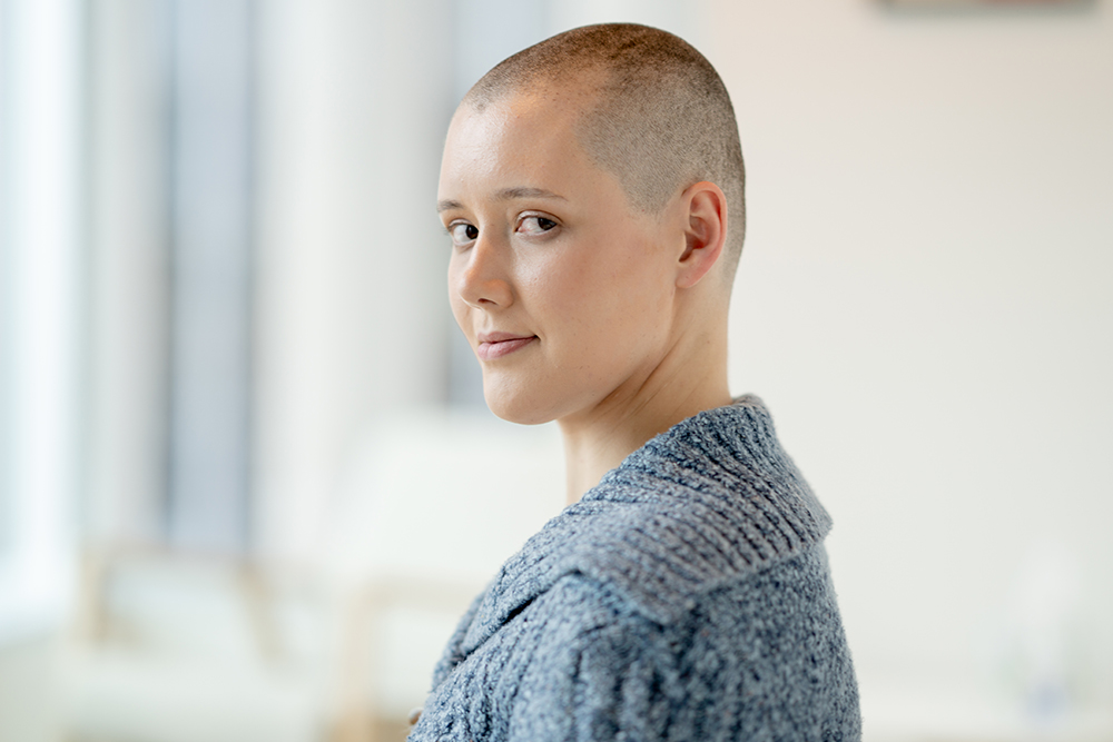 Alopecia Treatment Specialists in Wisconsin for Men & Women