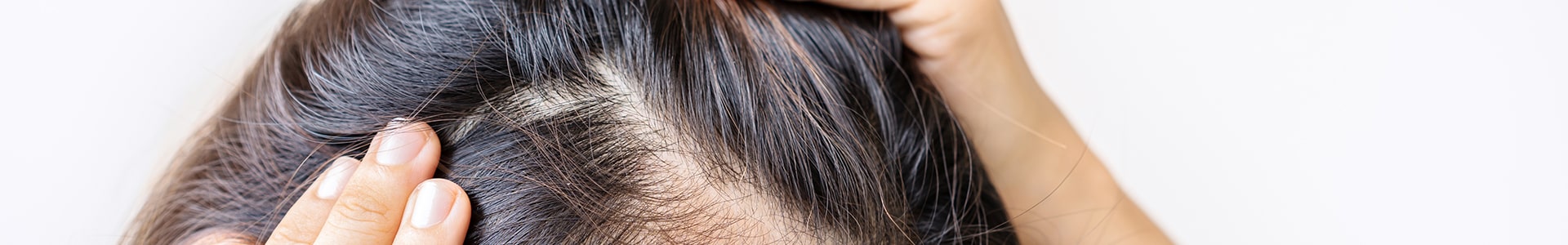 Find Personalized Hair Loss Treatments for Women from DCP