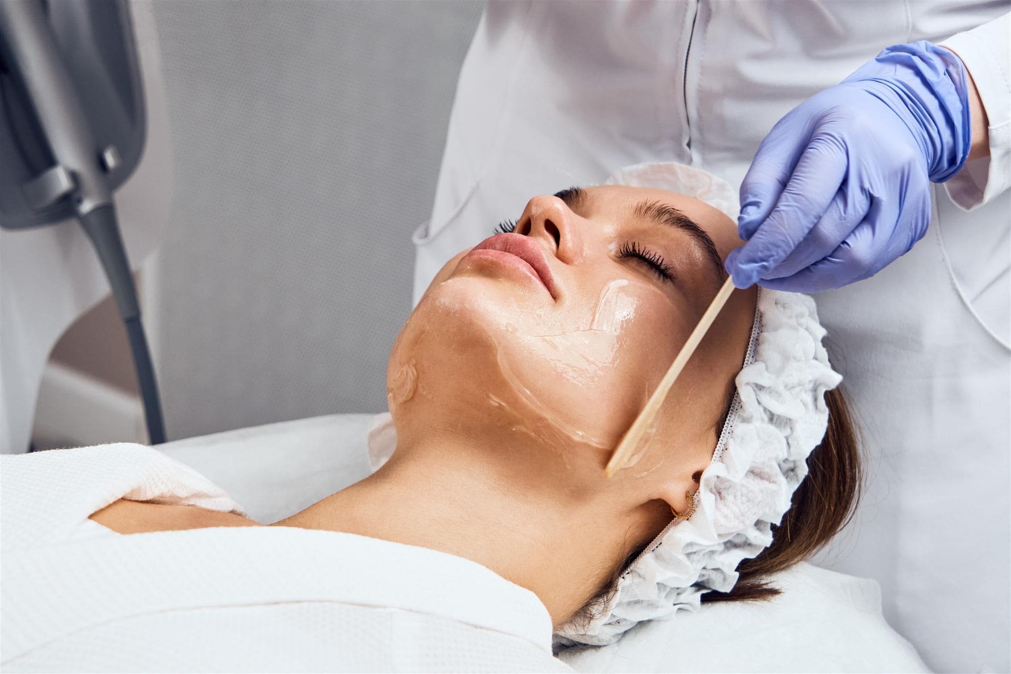 Chemical peels are available through DCP Chemical peels