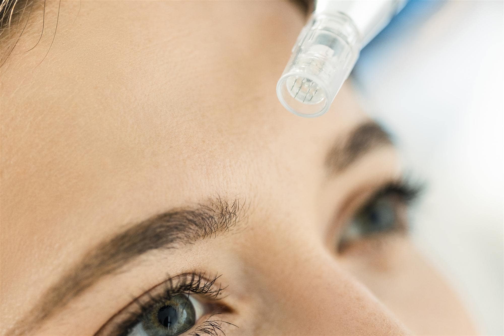 Dr. Steffes provides laser therapy treatments for many scars laser therapy treatments for many scars