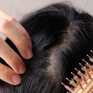 patient-focused hair loss treatments